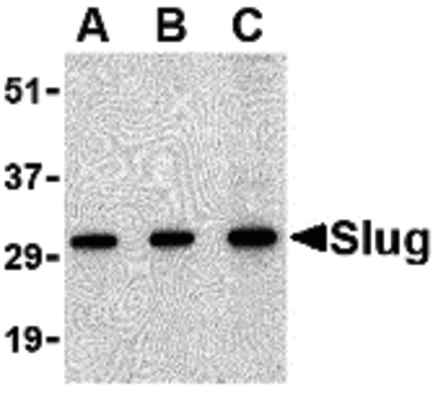 IHC-plus™ SNAI2 / SLUG Antibody