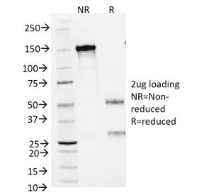Small Cell Lung Carcinoma (SCLC) Antibody (clone MOC-52, Azide-free, BSA-free)