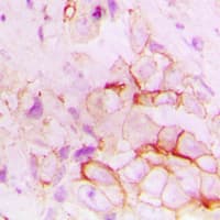 Polyclonal Rabbit anti-Human ACE / CD143 Antibody (Internal, IHC, WB)