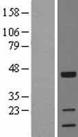 Human TOB1 / TOB Protein (Over-Expression Lysate Myc-DDK (Flag))