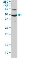 ADCYAP1R1 / PAC1 Receptor Antibody (clone 2B12)