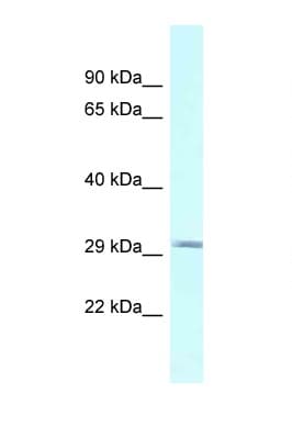 BSPRY Antibody (aa118-167)