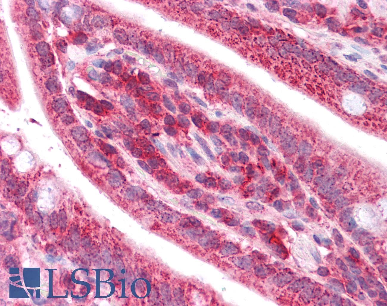 Rhodanese / TST Antibody (aa101-150)