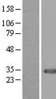 MEOX1 Protein (Over-Expression Lysate Myc-DDK (Flag))