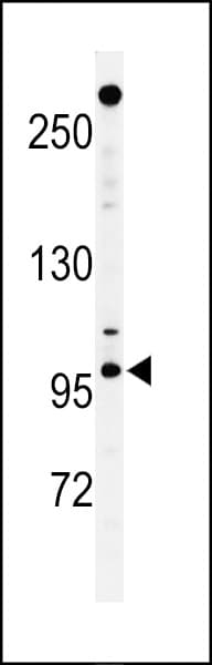 NUP210 / gp210 Antibody (aa202-231)