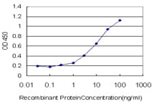IHC-plus™ TLN1 / Talin 1 Antibody (clone 2E10)