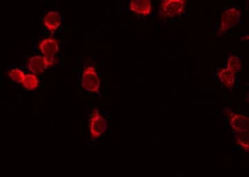 Polyclonal Rabbit anti-Human IL7R / CD127 Antibody (IHC, IF, WB)