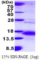 Human BTC / Betacellulin Protein (Recombinant His)