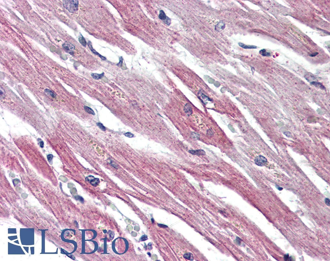 IHC-plus™ Polyclonal Rabbit anti-Human EPHX2 / Epoxide Hydrolase 2 Antibody (C-Terminus, IHC)