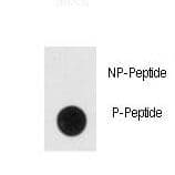 ENO2 / NSE Antibody (phospho-Tyr236)
