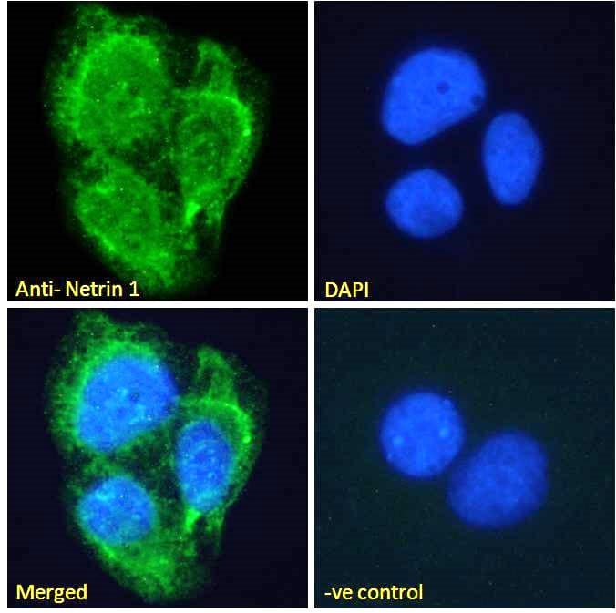 PathPlus™ NTN1 / Netrin 1 Antibody (aa591-604)