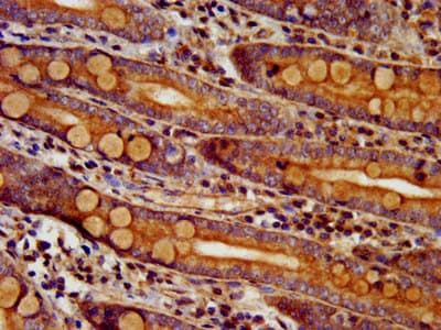 Polyclonal Rabbit anti-Human DTNBP1 / Dysbindin Antibody (IHC, IF)
