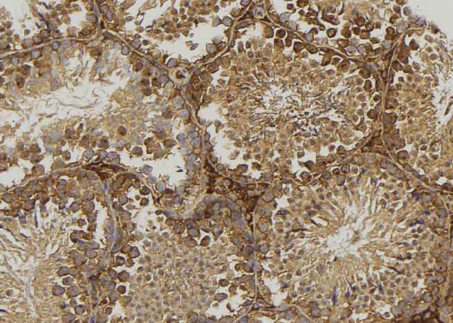 DRD1 / Dopamine Receptor D1 Antibody
