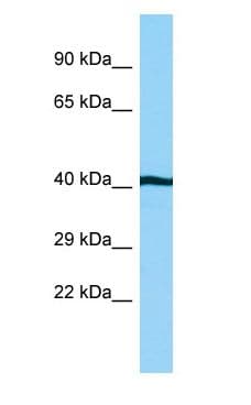 AHSA1 / AHA1 Antibody (aa169-218)