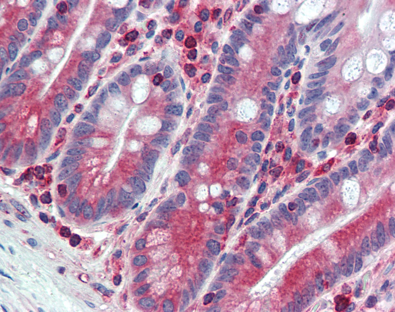 IHC-plus™ Polyclonal Rabbit anti-Human ESYT1 Antibody (C-Terminus, IHC)