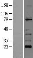 RIPK1 / RIP Protein (Over-Expression Lysate Myc-DDK (Flag))