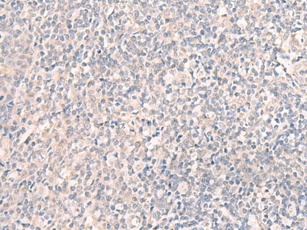 Polyclonal Rabbit anti-Human CCDC47 Antibody (IHC, WB)
