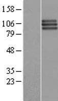 Human FGFR3 Protein (Over-Expression Lysate Myc-DDK (Flag))