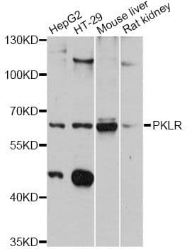 PKLR Antibody
