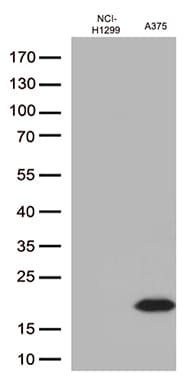 Monoclonal Mouse anti-Human CTAG1B / NY-ESO-1 Antibody (clone UMAB72, IHC, IF, WB)