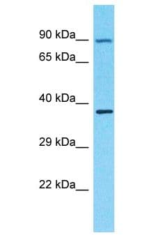 OR4F3 Antibody (aa199-248)