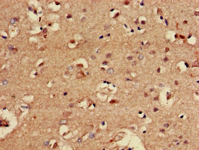 Polyclonal Rabbit anti-Human CBX5 / HP1 Alpha Antibody (IHC, WB)
