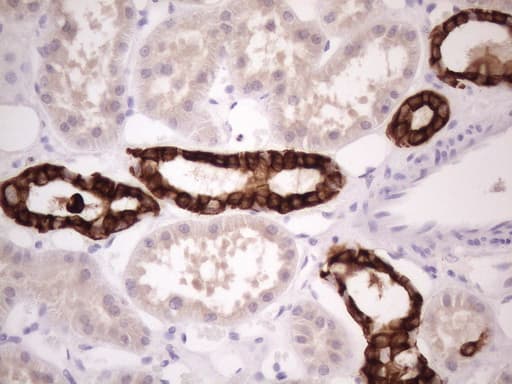 KRT16 / CK16 / Cytokeratin 16 Antibody (clone OTI1G5)