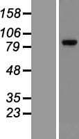 Human NR3C1/Glucocorticoid Receptor Protein (Over-Expression Lysate Myc-DDK (Flag))