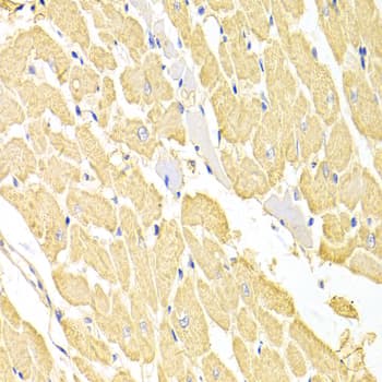 Polyclonal Rabbit anti-Human RRM2 Antibody (IHC, IF, WB)
