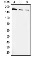 IHC-plus™ Polyclonal Rabbit anti-Human EEA1 Antibody (N-Terminus, IHC, WB)