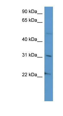 SCG3 / Secretogranin 3 Antibody (aa337-386)