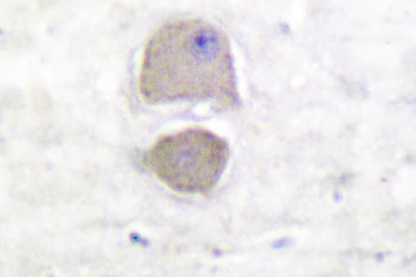 Polyclonal Rabbit anti-Human BAX Antibody (Ser4, IHC, WB)