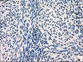 FRK Antibody (clone OTI7H3)