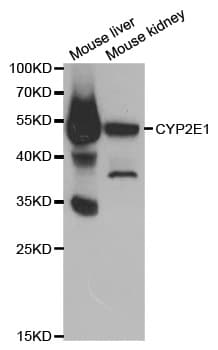 CYP2E1 Antibody
