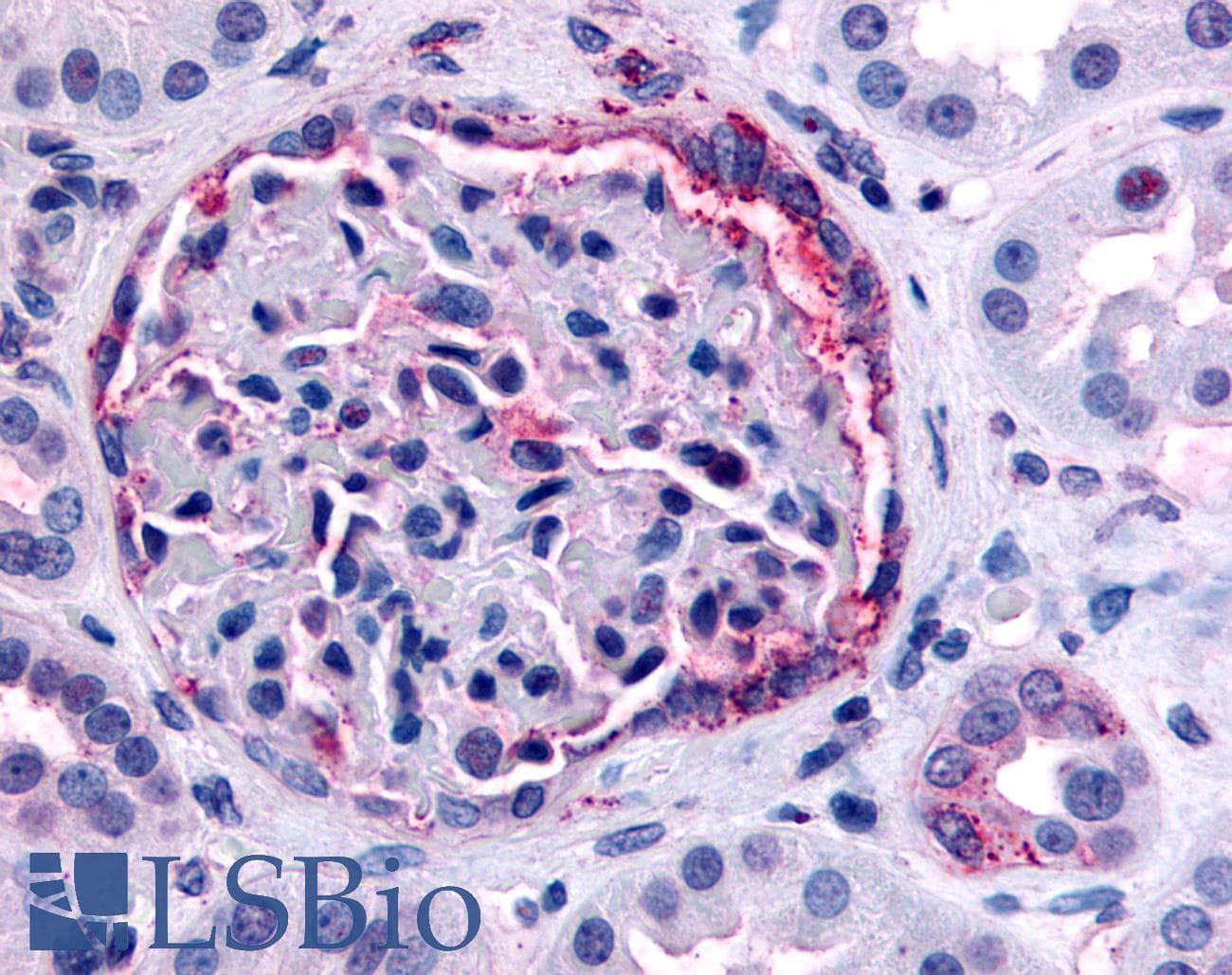 IHC-plus™ Polyclonal Rabbit anti-Human INPP5J / PIB5PA Antibody (C-Terminus, IHC)