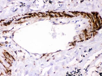 Polyclonal Rabbit anti-Human PTPN11 / SHP-2 / NS1 Antibody (IHC, WB)