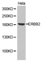 CD207 / Langerin Antibody