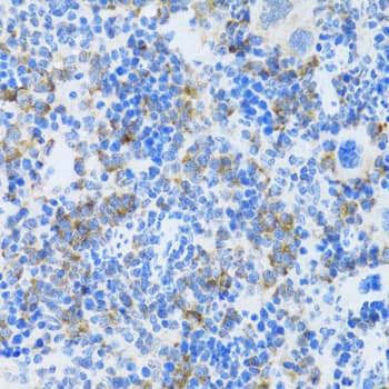 Polyclonal Rabbit anti-Human MAPK10 / JNK3 Antibody (IHC, WB)