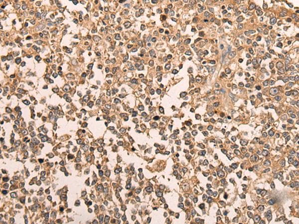 Polyclonal Rabbit anti-Human LDAH Antibody (IHC, WB)