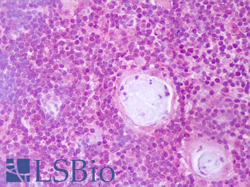 IHC-plus™ IL2 Antibody