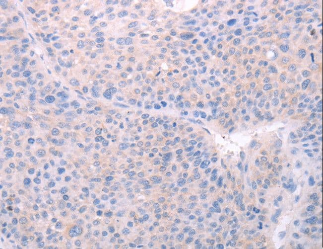 SPATA6 / SRF-1 Antibody