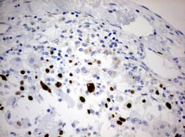 MKI67 / Ki67 Antibody (aa1160-1493, clone OTI5D5)