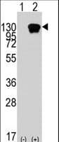 Polyclonal Rabbit anti-Human ROR1 Antibody (IHC, WB)