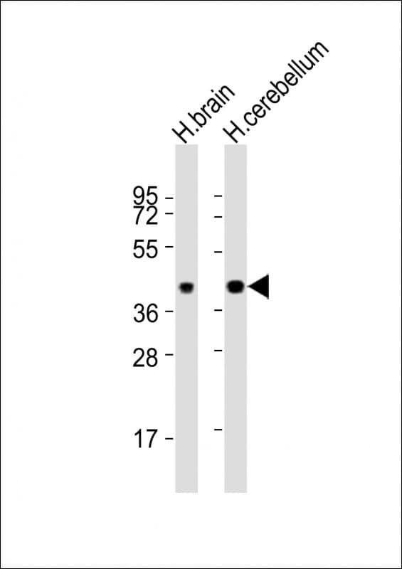 SH3GL2 Antibody (aa127-158)