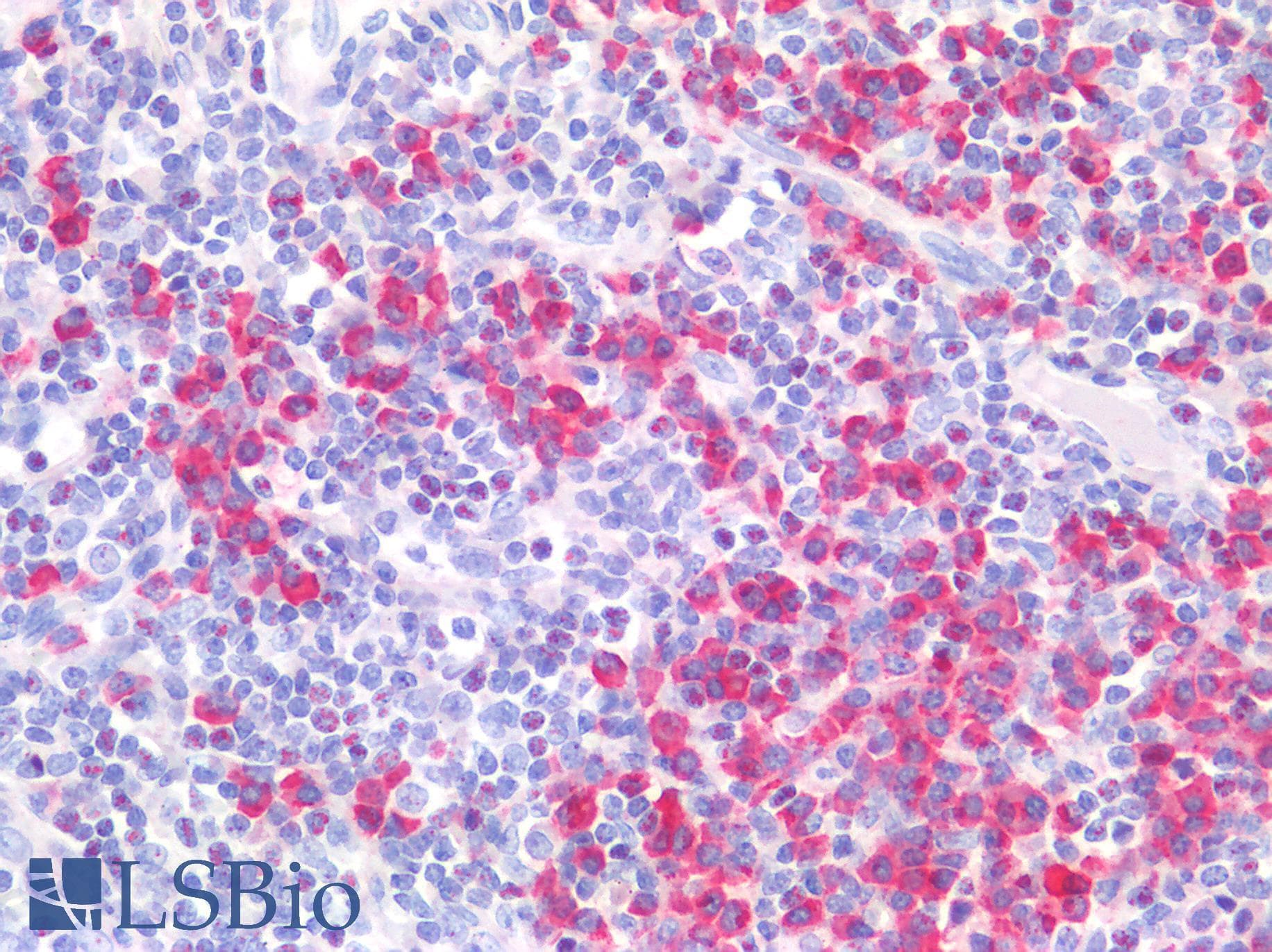 IHC-plus™ PIM1 / Pim-1 Antibody