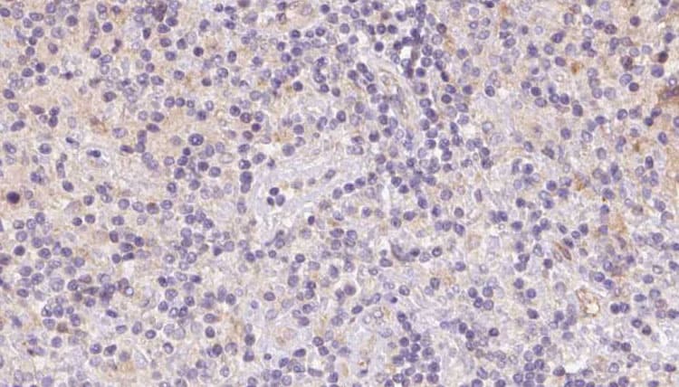 Polyclonal Rabbit anti-Human VPS16 Antibody (IHC, IF, WB)