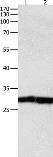 Polyclonal Rabbit anti-Human DUSP6 / MKP3 Antibody (IHC, WB)
