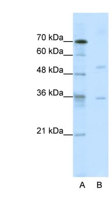 DATF1 / DIDO1 Antibody (aa72-121)