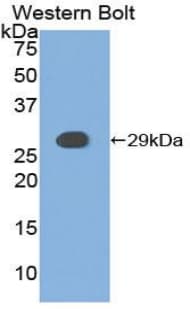 CSNK1A1 / CK1 Alpha Antibody (aa114-324)