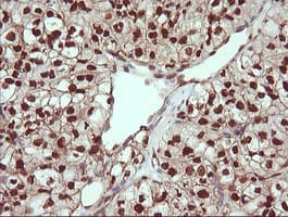 TRIM38 Antibody (clone OTI113D3)